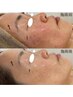 年齢肌の曇りに◎潤いケア×ツヤ仕込みで肌印象を底上げ！セルマン60分