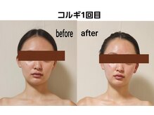 セレブリティ(Celebrity)の雰囲気（小顔コルギオルチャン/コルグン骨筋 /背中コルギ/カッサ）