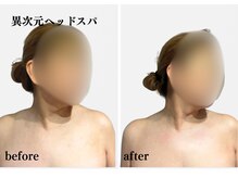 オトサロン(Otosalon)/首の可動域狭くないですか？