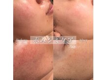 セレア(CELEA)の雰囲気（小顔以外も、毛穴、シミケアなどの施術も結果重視です！お気軽に）