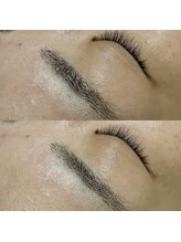 アミュレット(amulette)/毛穴ゼロ肌へ☆エンビロン