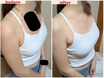 スノードロップ(snowdrop)/