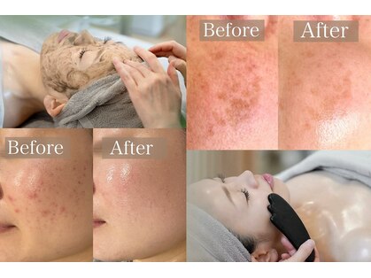 ルラシェ(Relacher)の写真