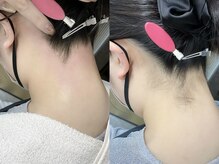 ネリネ 天神(nerine)/うなじワックス☆ワックス脱毛