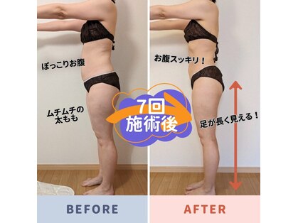ヨサパーク アエル(YOSA PARK AELL)の写真