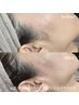 【再来】単品　ツヤ肌フェイスwax(全顔)+パック付