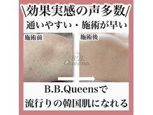 ビービークイーンズ(B.B. Queens)の雰囲気（【脱毛】リピート率90％以上の脱毛効果）