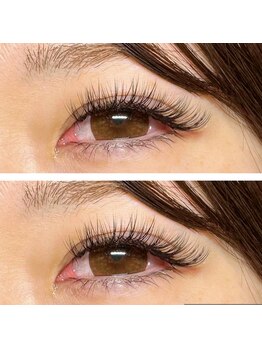 ルートレム(Root/R3:M)/フラットラッシュ付け放題