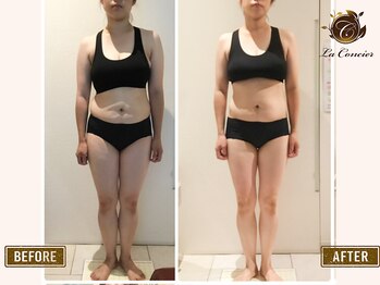 ラ コンシェル 武蔵小杉店/痩身マシン×骨盤矯正