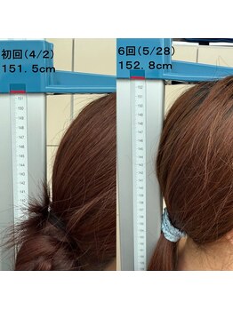 痩身 セル脂肪専門 スタイルデザイン/身長1.3cmアップ★美容整体