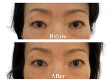 モリタ鍼灸整骨院/美肌リフトフェイシャル