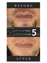 エアリアル 八代店/5回ほどでかなり変化！