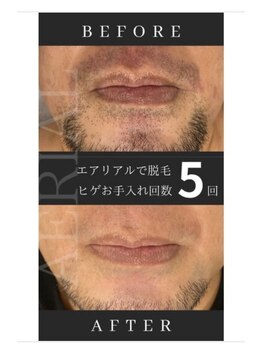 エアリアル 八代店/5回ほどでかなり変化！