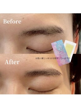 ビオラス(Biolus)/【メンズまゆげ】Before/After