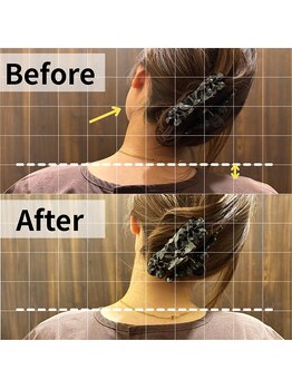 ここいろ/【Before/After】ぎっくり首・肩