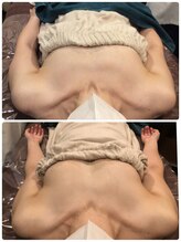 プラチナアース つくば店(Platinum earth)/バストケアビフォーアフター