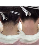 ユアアイサロン(ur.eyesalon)/うなじWax