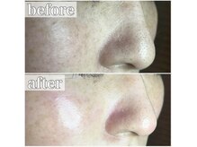 エクレ 下北沢店(ecle)/ツヤ肌手に入れたいならエクレへ