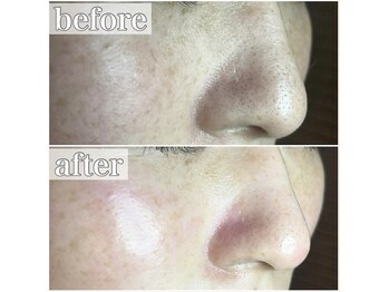 エクレ 下北沢店(ecle)/ツヤ肌手に入れたいならエクレへ