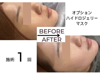 ベガ(Vega)/OP/ハイドロジェリーマスク