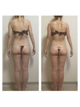 ホズリル(Hozril)/全身痩身100分コース