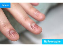 ネイルカンパニー/