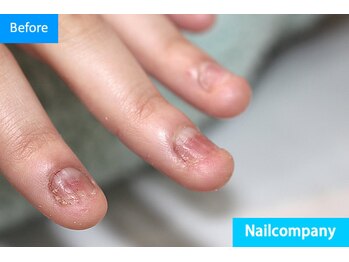 ネイルカンパニー/