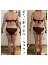 サロン ド モナ(salon de mona)/【ビフォーアフター】美脚エステ