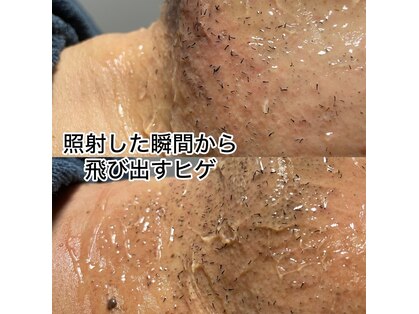 オアシス メイエキ(Oasis ｍeieki)の写真