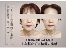 ベラ 東京院(Bella)/たるみは原因から根本アプローチ