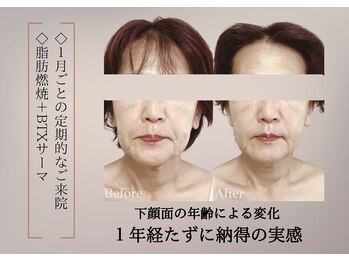 ベラ 東京院(Bella)/たるみは原因から根本アプローチ