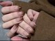 ピンキーネイル(Pinky Nail)の写真