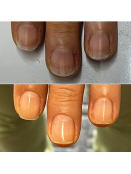 プレシオサ ネイル(Preciosa Nail)/育成