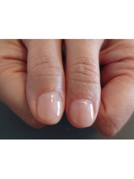 爪の悩みを解消できる（ケア含む）