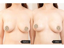 シークレット(Secret)