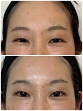 ルミア(LUMIA)/ロイヤルフルコース3回目