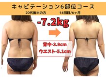 ビーバランス 本町店(美-Balance)/20代後半　月7部位コース