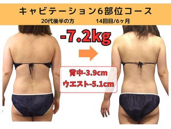 ビーバランス 本町店(美-Balance)/20代後半　月7部位コース