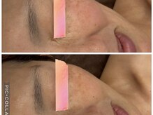 イディアル(IDE'AL)/韓国肌管理ミディアムコース