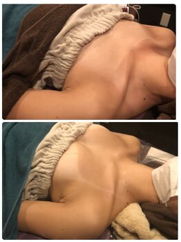 プラチナアース つくば店(Platinum earth)/バストケアビフォーアフター