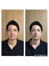 マカニ 河原町御池(makani)/小顔矯正ビフォーアフター