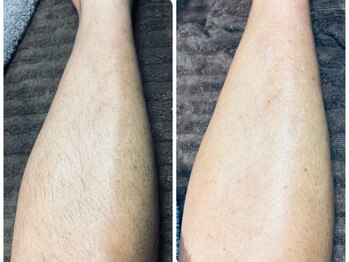 パムワックス(Pam WAX)の写真/痛みの少ない施術がPAMの強み！男性の太い毛も痛みを少なく美肌に導く♪すね毛・脇毛・腕毛もお任せあれ◎