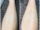 パムワックス(Pam WAX)の写真/痛みの少ない施術がPAMの強み！男性の太い毛も痛みを少なく美肌に導く♪すね毛・脇毛・腕毛もお任せあれ◎