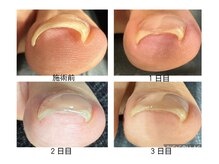 ベルル(Bellulu)の雰囲気（巻き爪でお悩みの方、ぜひお気軽にご相談ください♪）