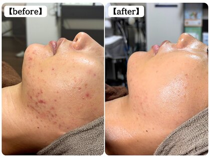 ボディコンディションの写真