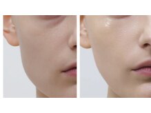 ペリドット(Peridot)/《最先端目元専用マシン導入》