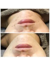 アウラ(AURA)/ダクトピール　before/after