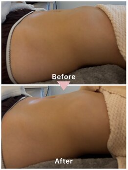 ポノ インディバ サロン(pono. Indiba salon)/お腹スッキリ♪