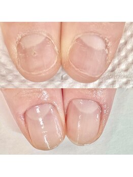 ネイル クリーミー(Nail Creamy)/ネイルケア