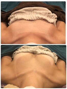 プラチナアース つくば店(Platinum earth)/バストケアビフォーアフター